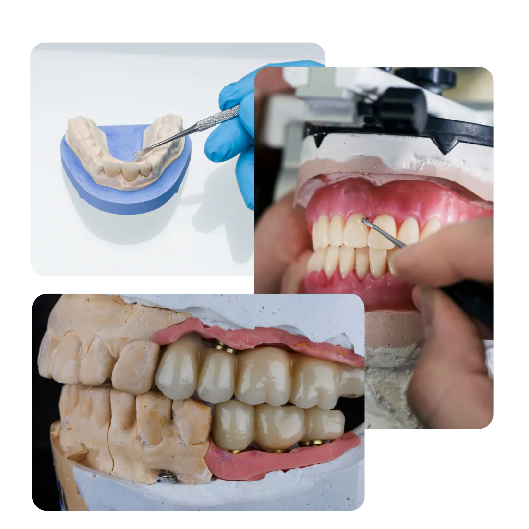 Imágenes del tratamiento dental